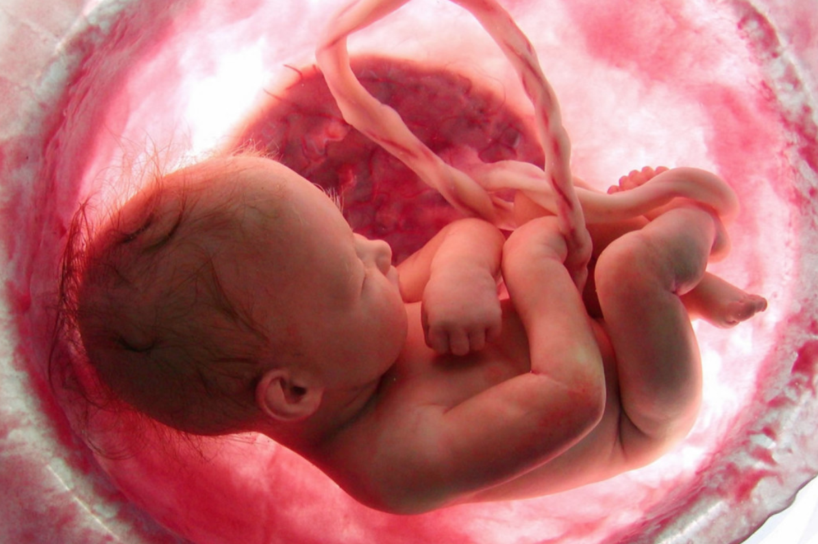 DAL MONDO – Nuova Zelanda: la legge abortista più estrema del mondo condanna i bambini a sofferenze atroci 1